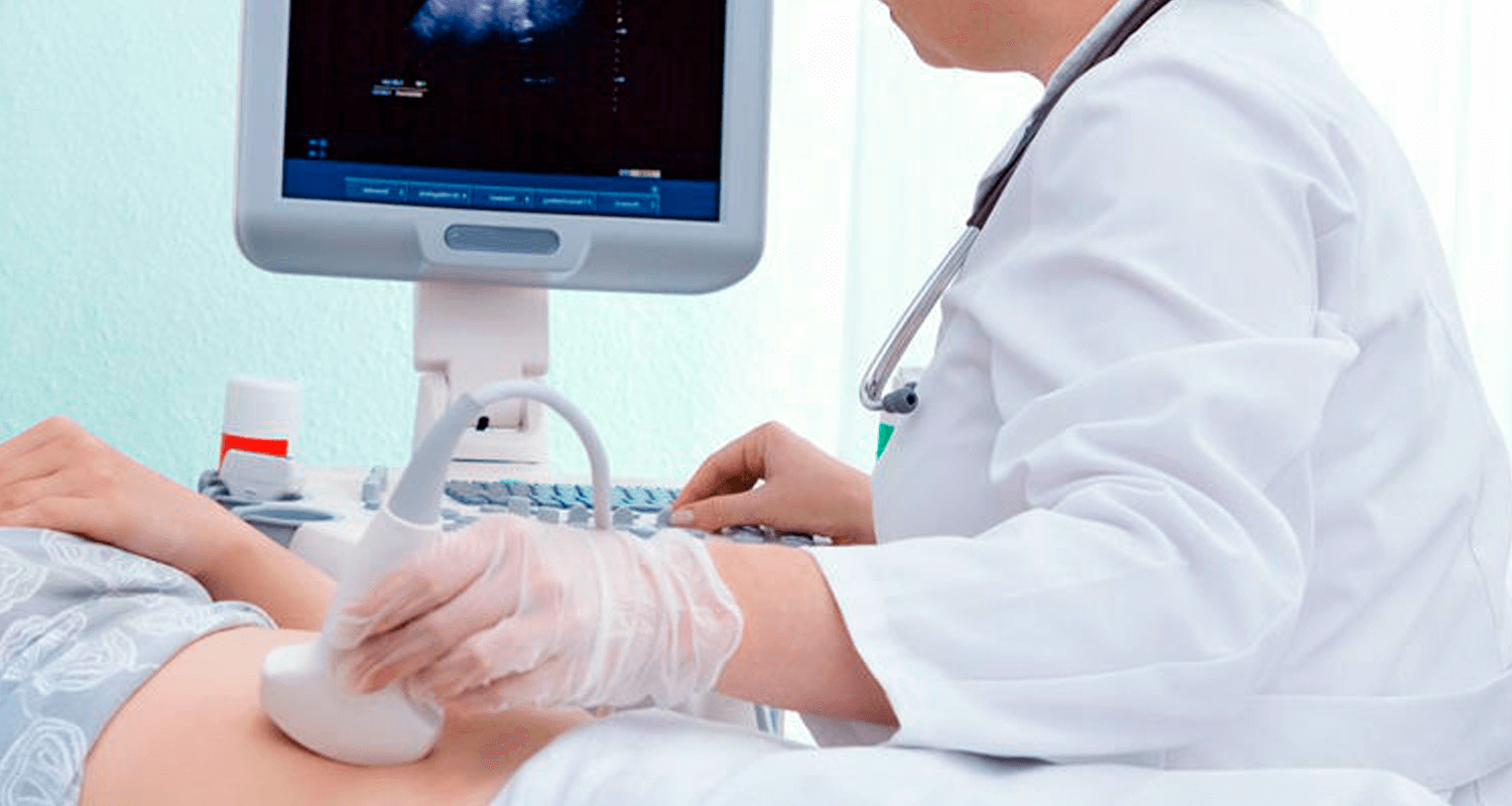 O que são ovários policísticos?