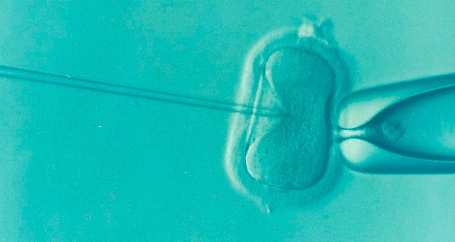 Estudo Afrodite em destaque no Jornal Expresso